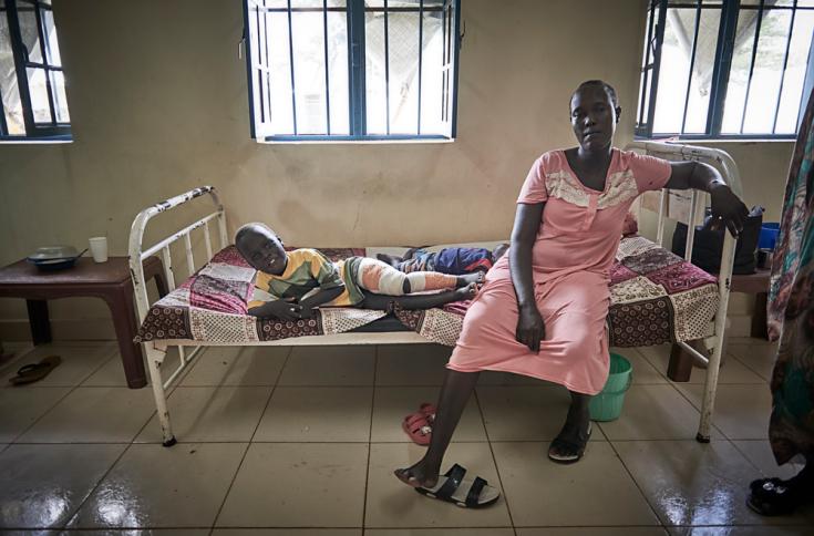 Niño con quemaduras en hospital Ameth-Bek en Sudán del Sur