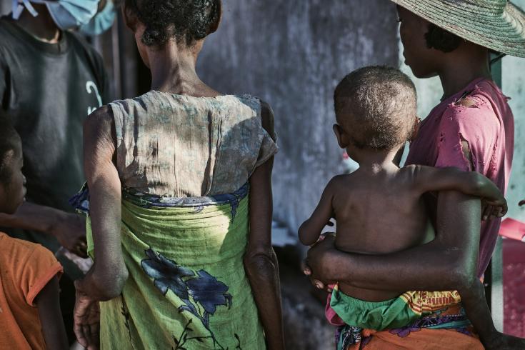 Emergencia de malnutrición - Clínica móvil en Ranobe, Madagascar