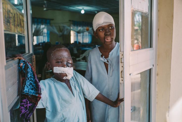 Niño recién operado en el Hospital Sokoto Noma, Nigeria. 