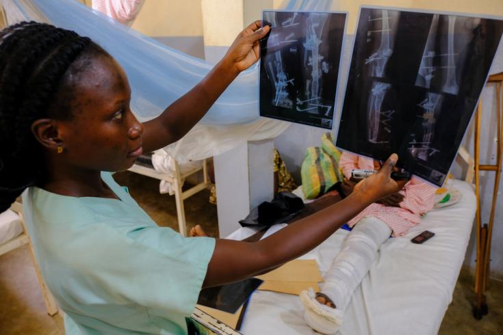 La fisioterapeuta Moulou Talba, del Ministerio de Salud, examina las imágenes de rayos X de un paciente que sufrió fracturas en una pierna después de un accidente de tráfico.