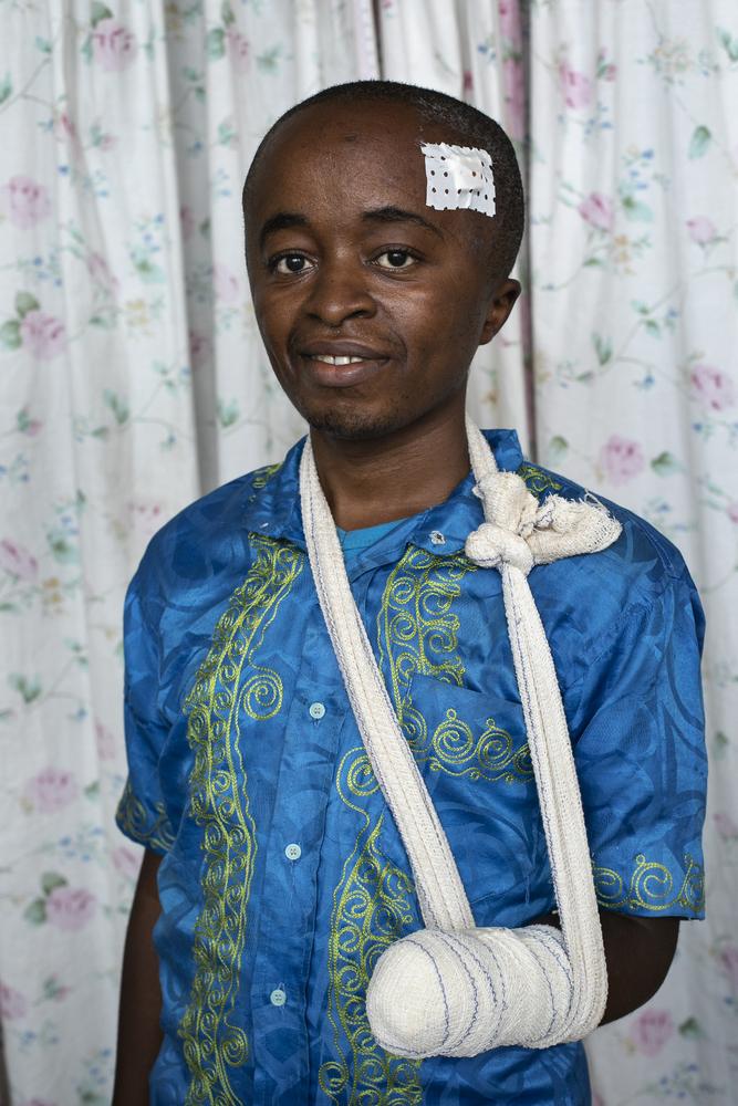 Félix y su familia fueron atacados por hombres armados y los atacantes cortaron su mano izquierda con un cuchillo. Félix fue al Hospital Saint Mary Soledad, apoyado por MSF, en Bamenda, noroeste de Camerún. . La foto fue tomada a principios de marzo de 2020, antes de que la pandemia de COVID-19 golpeara la región.
