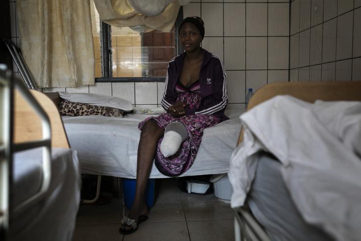 Ornella (27), perdió la pierna izquierda tras un accidente de tráfico. En el hospital Saint Mary Soledad, en Bamenda, noroeste de Camerún, los cirujanos de MSF intentaron salvarle la pierna durante tres meses, pero finalmente tuvieron que amputarla. . La foto fue tomada a principios de marzo de 2020, antes de que la pandemia de COVID-19 golpeara la región.