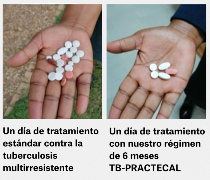 Diferencia de tratamiento convencional de turberculosis multirresistente con el tratamiento de Médicos Sin Fronteras.